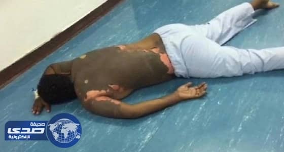 الإفراج عن مصور فيديو " الزوج المحروق " في بيشة بكفالة