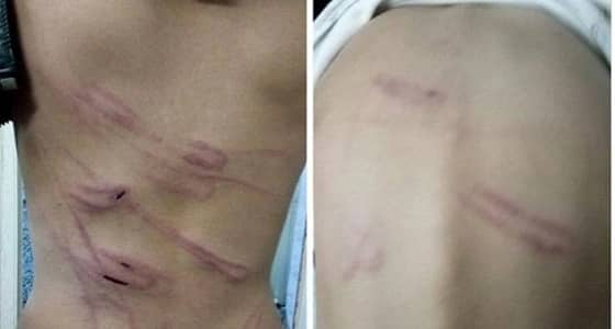 الشرطة تلقي القبض على أب يعتدي على أبنائه بالباحة