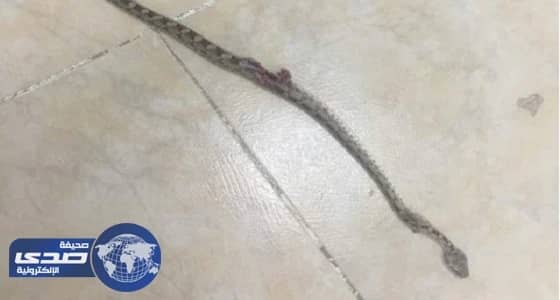 لدغة ثعبان تكشف الاهمال الطبي بجنوب القويعية