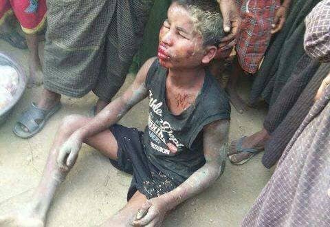 حكومة ميانمار تعذب طفل بوحشية بتهمة صيد الأسماك