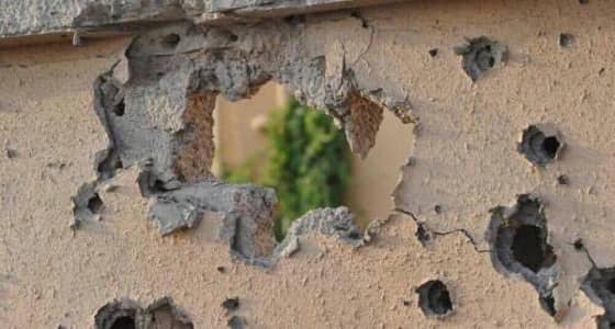 المواطنة المصابة إثر مقذوف حوثي بنجران تغادر المستشفى