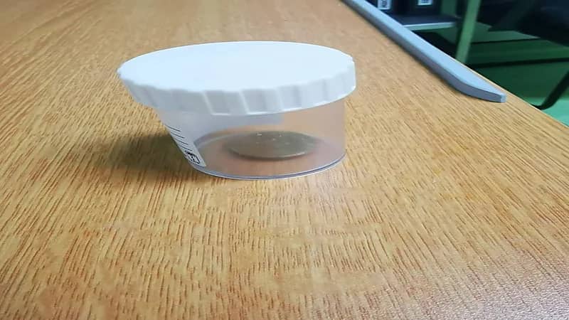 طفل يبتلع عملة معدنية في الطائف