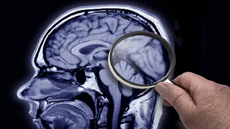 علماء يحددون شبكة اللغة العالمية في الدماغ