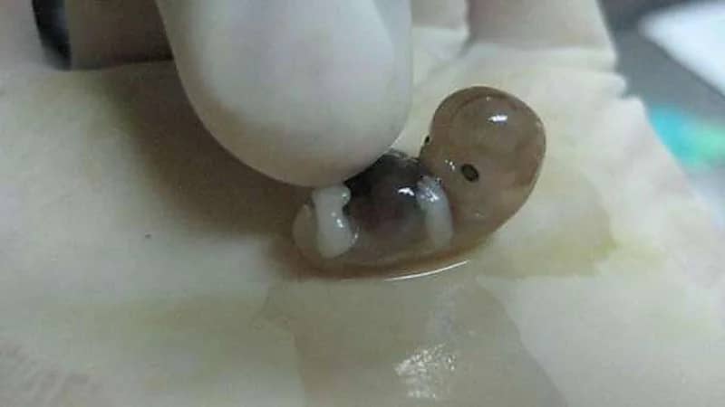 الأردن.. العثور على جثة جنين داخل "مرطبان"بالشارع