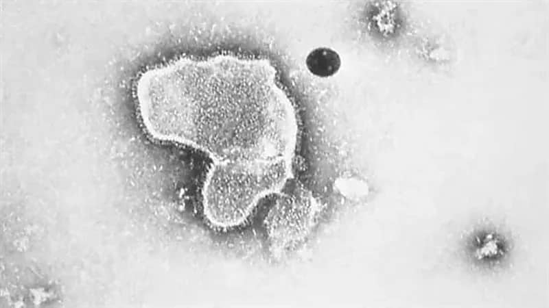 مخاوف من فيروس غامض يقضي على الأطفال في أمريكا