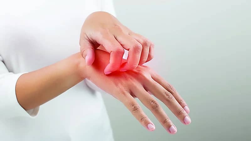 أدوية قد تزيد حساسية الجلد عند التعرض للشمس .. فيديو