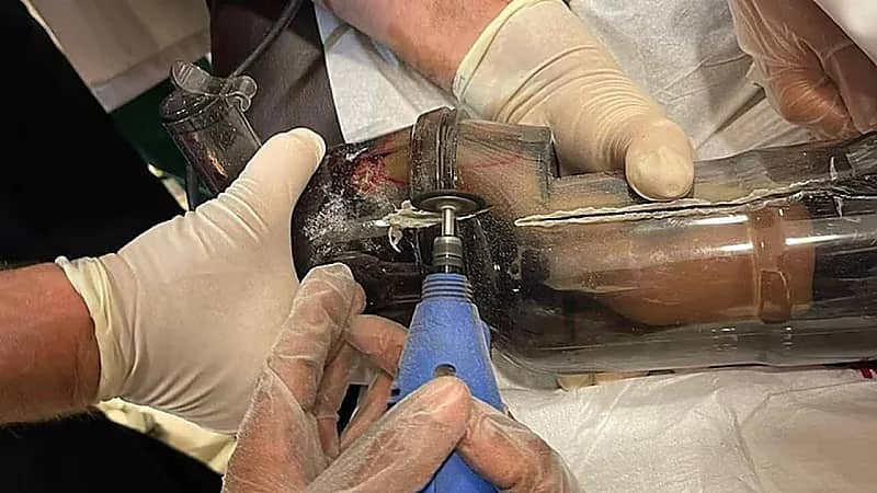 مدني الرياض يحرر يد طفلة علقت في خلاط