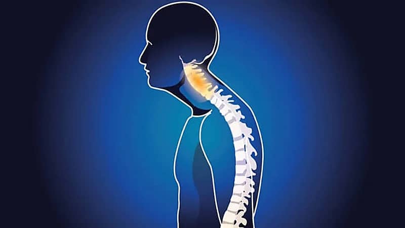 مختص يوضح الأسباب التي تؤدي للإنحناء وأعراضه .. فيديو