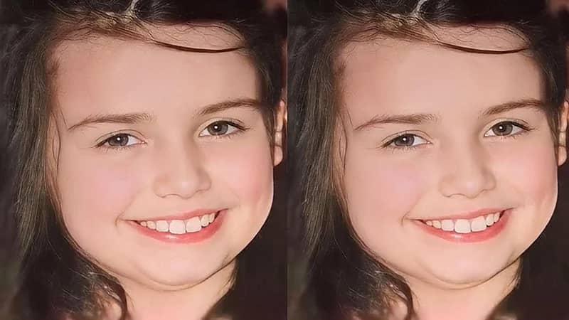 وفاة طفلة أمريكية بسبب إصابتها بقمل الشعر .. فيديو