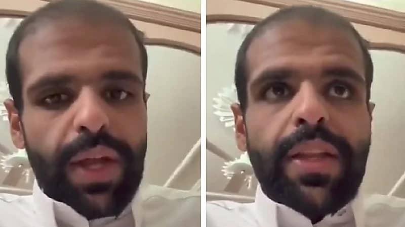 شاب بعد إجرائه عملية تكميم : وجهي صار أكبر من عمري وصار عندي صلع .. فيديو