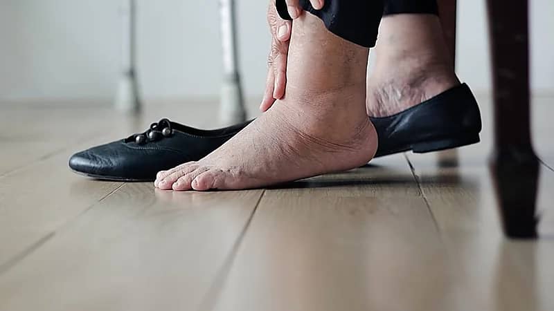 احذر .. 5 علامات تظهر على الساقين تشير إلى مشاكل صحية خطيرة