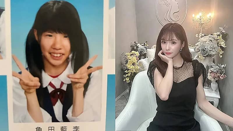 سيدة تخضع  لأكثر من 20 عملية تجميل بسبب تعرضها للتنمر