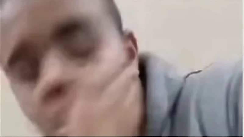 فتاة تصفع طبيب أسنان داخل عيادته