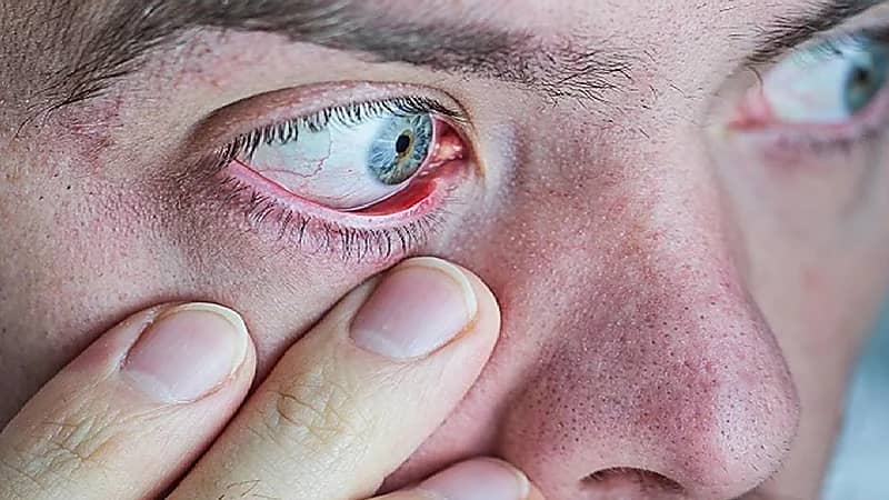 علامات في العين تكشف عن أعراض مبكرة للخرف