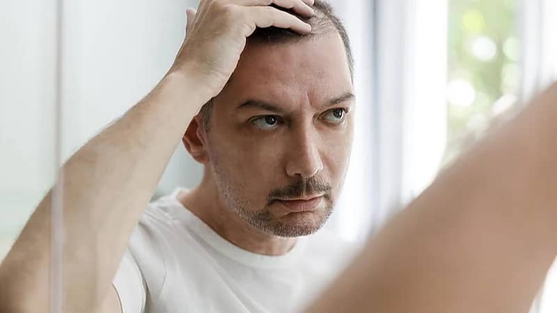 تساقط الشعر الغير مبرر دليلاً على الإصابة بالزهري