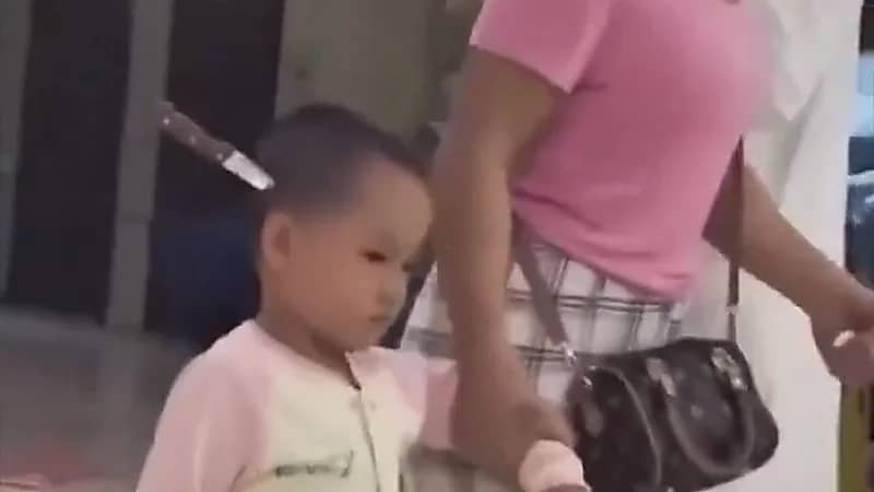 طفلة تصل المستشفى مع والدتها بسكين في جمجمتها دون دموع وتثير الجدل ..فيديو