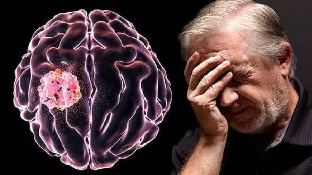 بعد وفاة مطرب المهرجانات دقدق : علامات تنذر بالإصابة بسرطان المخ