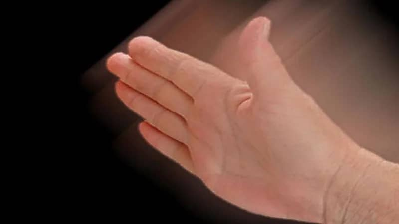 موظف يسبب عاهة مستديمة لمسعفة في دبي