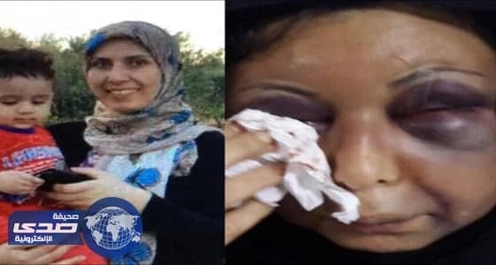 بالفيديو.. قصة سورية تعدى زوجها عليها بوحشية فتحولت لقضية رأي عام