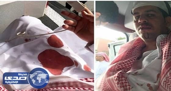 بالفيديو.. اليمني المعتدى عليه من قبل الأمير سعود يسرد تفاصيل الواقعة