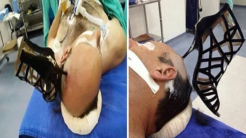 حقيقة ضرب امرأة لزوجها وإصابته في رأسه بالجبيل