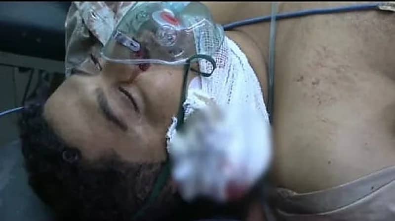 قناص حوثي يستهدف يمنيًا أثناء جلوسة بجوار منزله