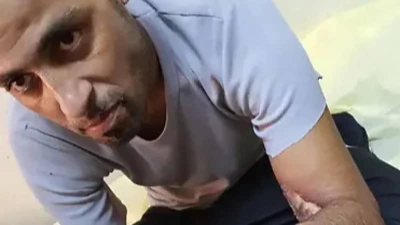 انتشار صور تقشعر لها الأبدان لتعذيب شاب على يد الشرطة تثير غضبًا واسعًا (فيديو)