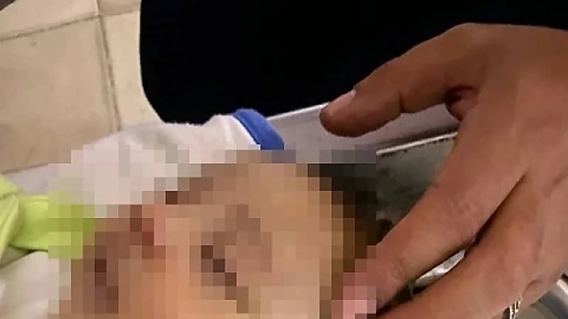 طبيبة تلقي رضيعة من النافذة عقب الولادة