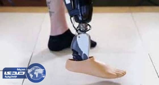 معلم بعسير يعرض كليته مقابل الحصول على اطراف صناعية