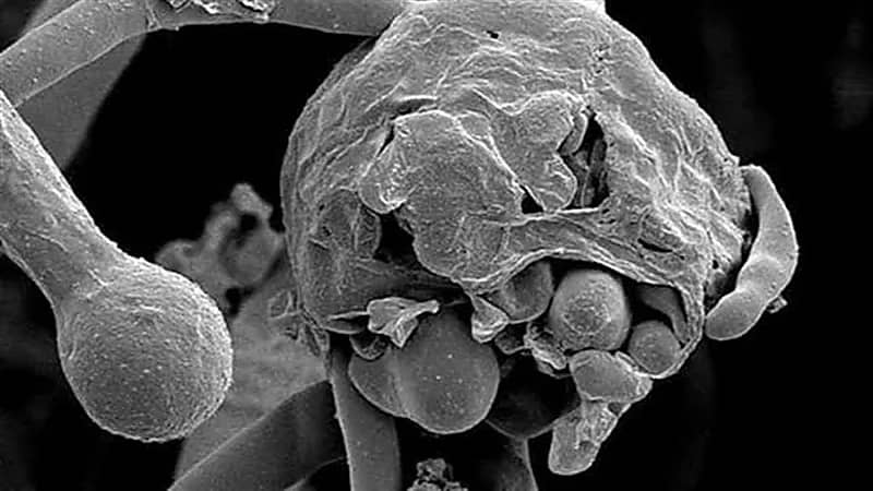 الفطر الأسود يقتحم سوريا بعد مصر والعراق 