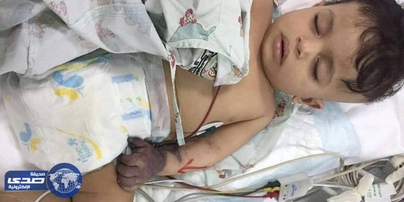 والد ضحية الخطأ الطبي يرفض بتر يده ويٌطالب بعلاجه..والصحة تعد بالتحقيق