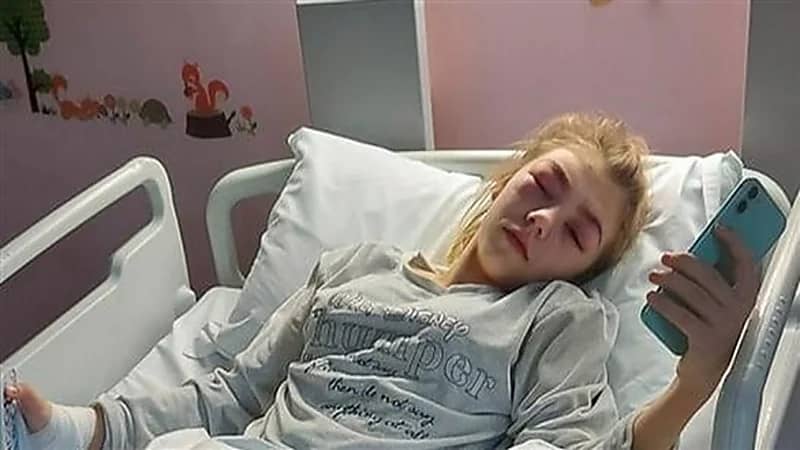 بالصور.. فتاة كادت تفقد بصرها بسبب صبغ حاجبيها ورموشها