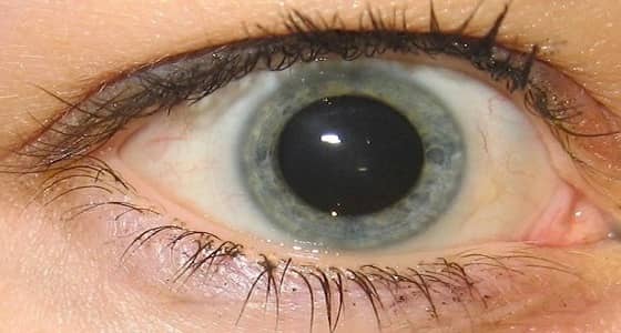 سيدة عربية كادت تفقد بصرها بعدما غيرت لون عينيها