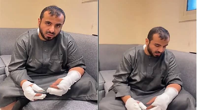 بالفيديو.. مفسر الأحلام محمد عجب يتعرض لحريق ويعلق: لحيتي راحت