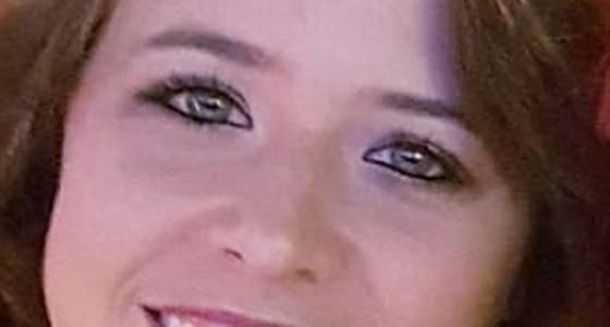 شاب يشوه جارته بإشعال النيران بها وهي حية