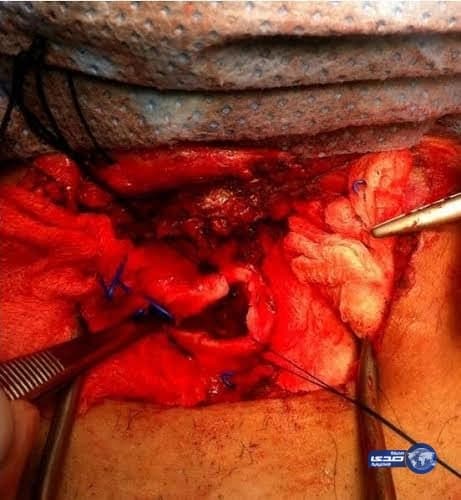 بالصور.. ضبط 9 مخالفات لـ«توطين قطاع الاتصالات» بالرياض