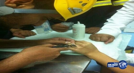 مستشفى شقراء يستعين بالمدني لتخليص شاب من خاتمه