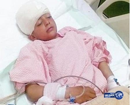 نجاح عملية فتح جمجمة لفتاه في مستشفى طريف العام