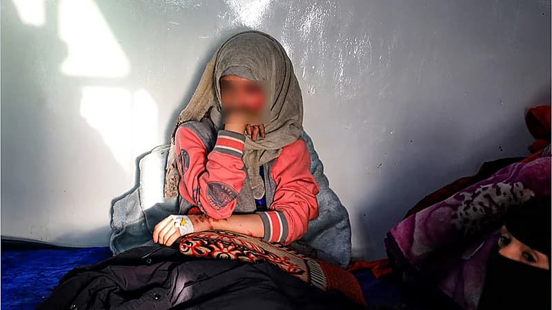 بالصور.. رجل يشوه وجه طليقته بالأسيد