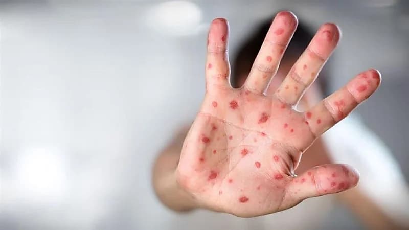 "الصحة العالمية" تحذر من تهديد وشيك في كل منطقة من العالم