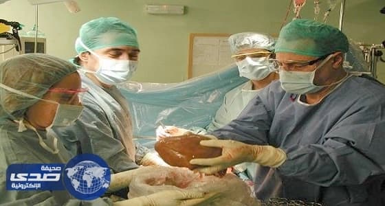 مدير المركز السعودي لزراعة الأعضاء ينفي منع الوافدين من التبرع