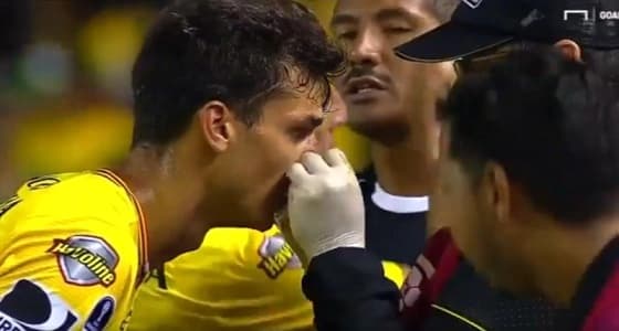 بالفيديو.. لاعب يتعرض لإصابة بالغة في بطولة كوبا سودا أميريكانا