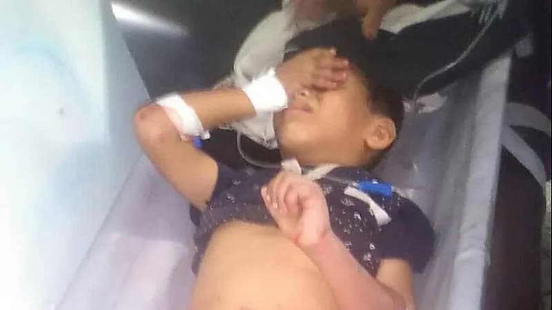 مقتل 3 أطفال بنيران حوثية في " إب "