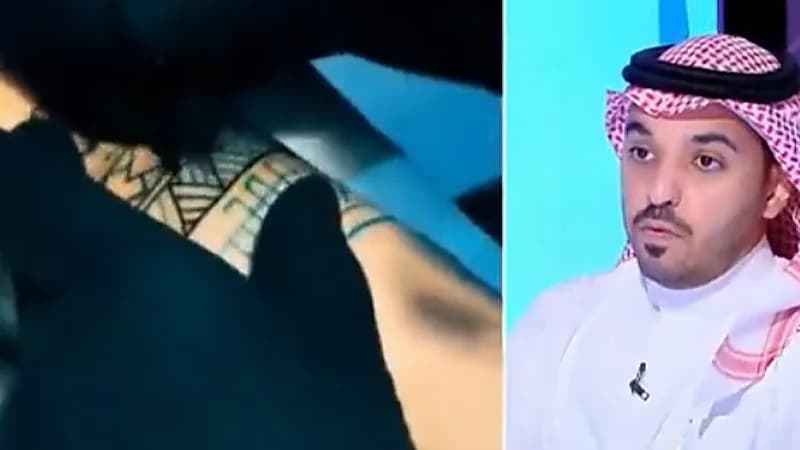 "استشاري" يوضح عدد الجلسات التي تحتاجها عملية إزالة الوشم ومضاعفاتها (فيديو)