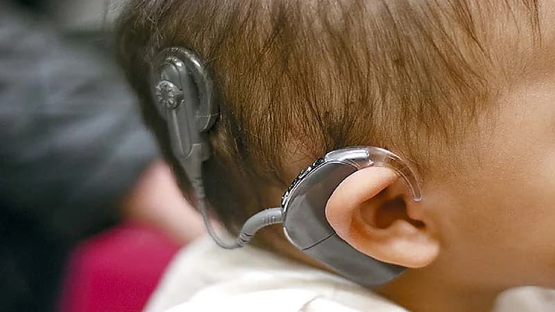 مختص: المملكة تقدم عمليات زراعة القوقعة مجاناً للأطفال