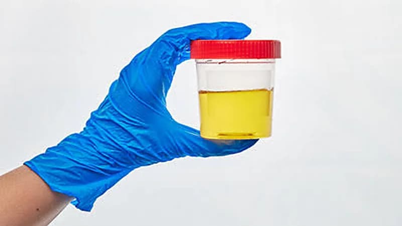 توجه لاستخدام البول البشري في الزراعة