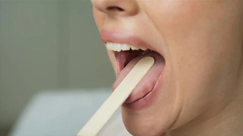 نسيج اللسان يكشف عن نقص فيتامين مهم