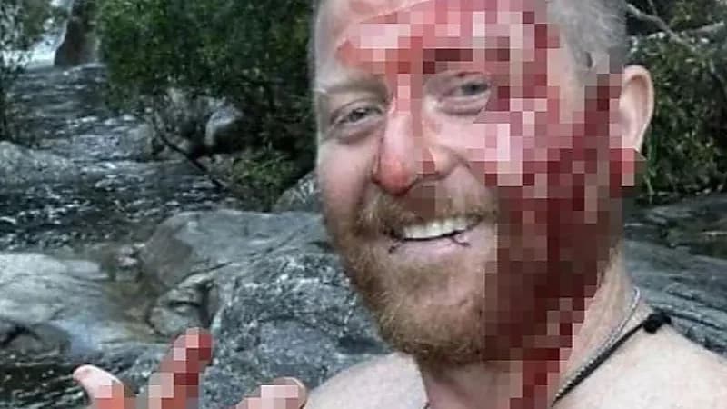 ثعبان ضخم يصفع رجلًا على وجهه بطريقة مؤلمة