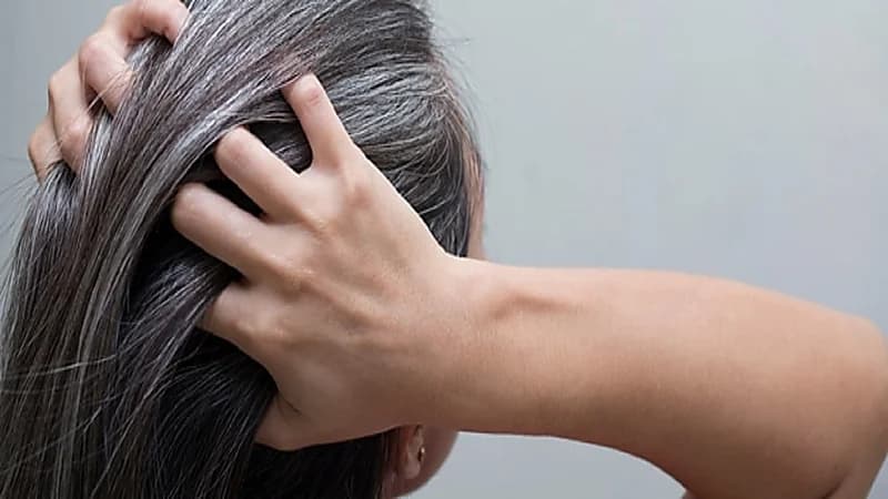 الشيب المبكر قد يكون علامة على أمراض القلب !