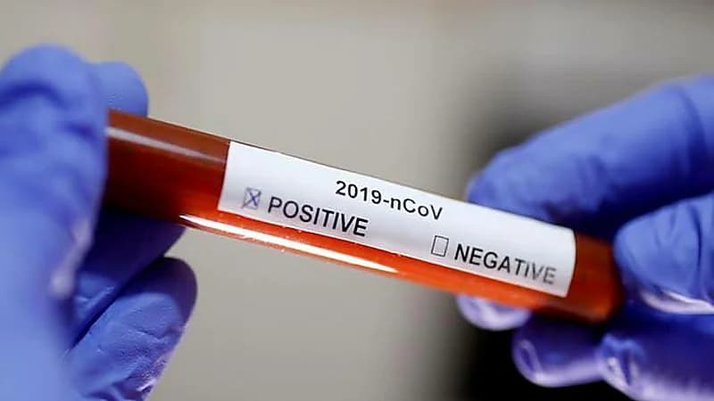 رجل يعرض بيع عينات من فيروس كورونا على الإنترنت